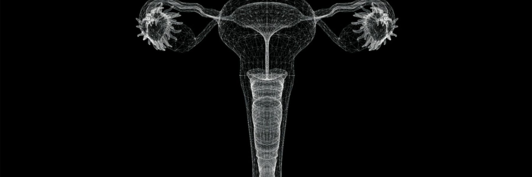Cervical Cerclage