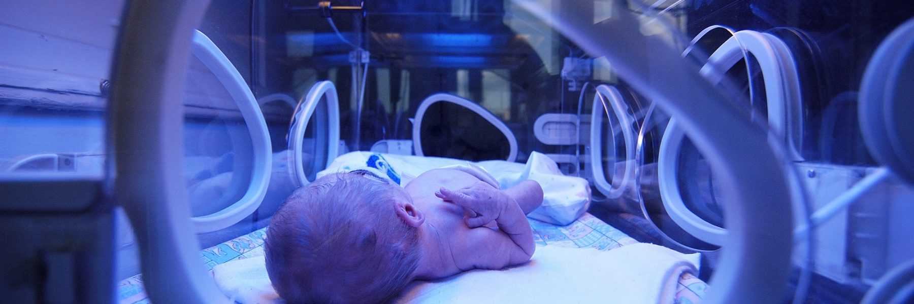 UTI-Neo (1) UTI-Neo (1)